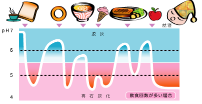 甘いものだけが虫歯を作るわけじゃない